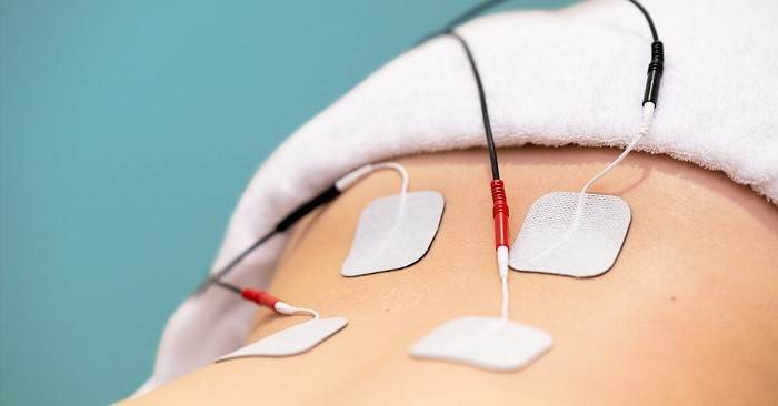 تحریک الکتریکی عصب جهت بهبود کمردرد