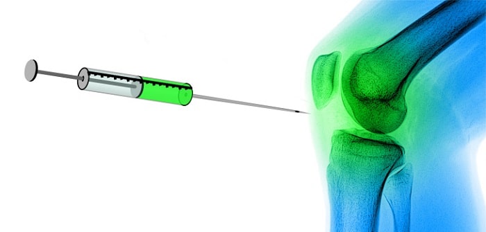 پرولوتراپی